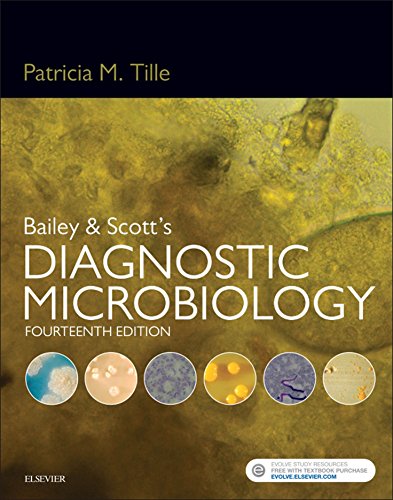 Bailey & Scott's Diagnostic Microbiology 14th Edition by Patricia Tille 2015 Test Bank